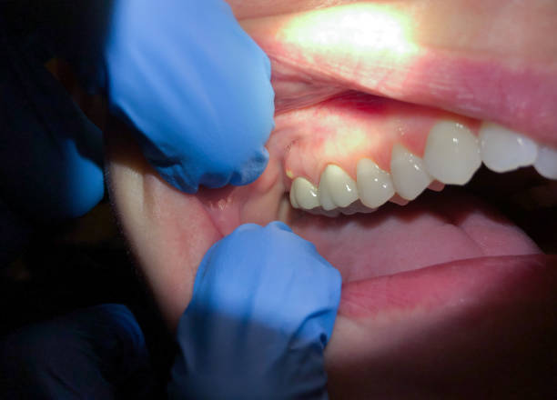 Best Mobile Emergency Dentist in Crestline, CA